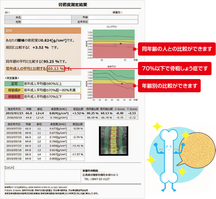 骨密度検査